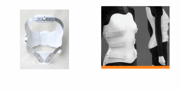 CORSET A MEDIDA - CORSET POLOPROPILENO TLSO, BOSTON